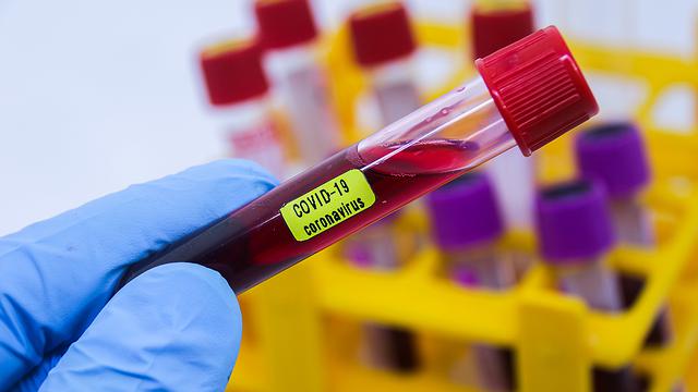 5d0a341f-d80e-46d2-b59e-4e3dc9345d7d.JPG.640x360_q75_box-0,219,4200,2581_crop_detail